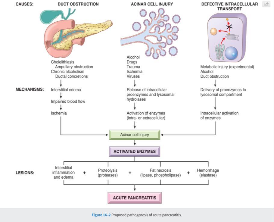 Morphology: The morphology of acute pancreatitis ranges from inflammation and edema to severe extensive necrosis and hemorrhage. The basic alterations are: 1. Microvascular leakage causing edema 2.