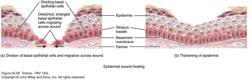 Epidermal Wound Healing
