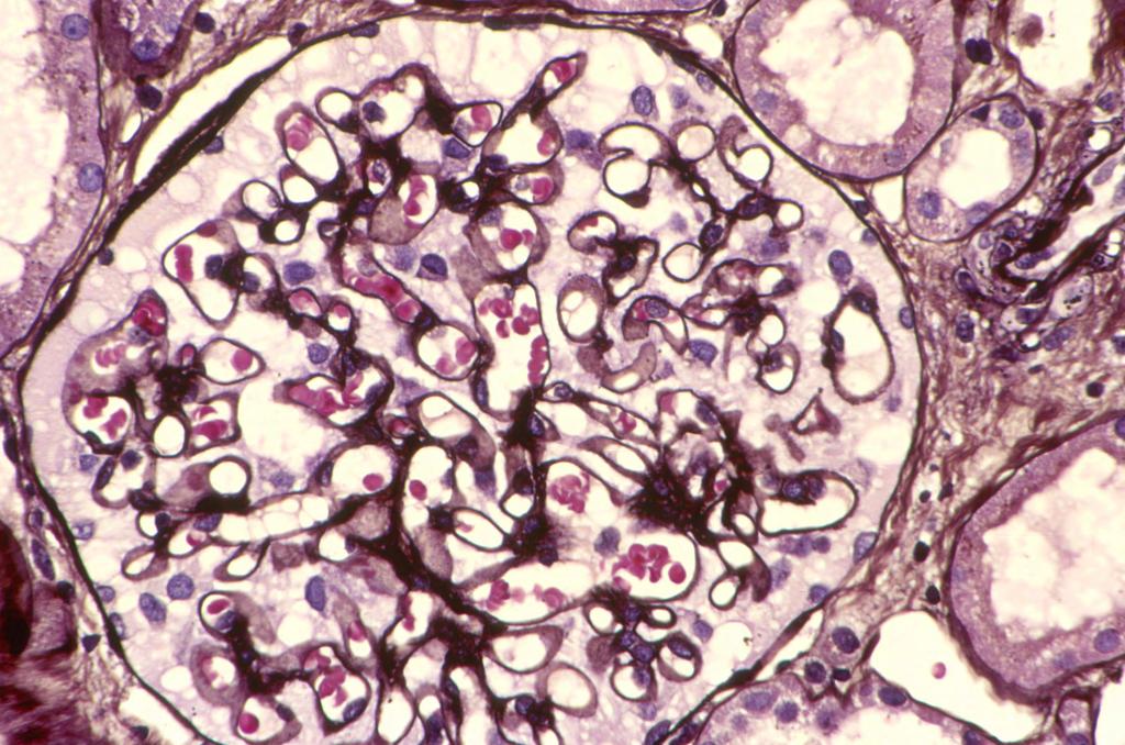 Special histochemical stains in addition to H&E, are used in the light microscopic