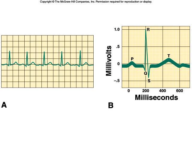 Electrocardiogram (ECG) can trace