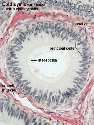 - Spermatids: which lie in the luminal part of the seminiferous epithelium. They are small (about 10 µm in diameter) with an initially very light (often eccentric) nucleus.