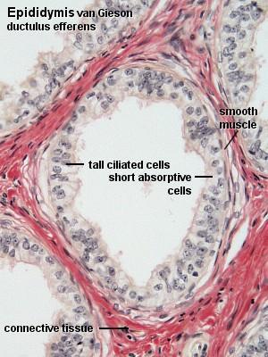 Lateral processes of Sertoli cells are interconnected by tight junctions, which are likely to be the structural basis for the blood-testis barrier.