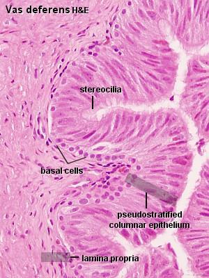 Smooth muscle fibres of the terminal part of the ductus epididymidis do not contract spontaneously.