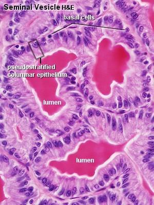 In good histological sections it is possible to distinguish three concentric zones, which surround the prostatic part of the urethra.