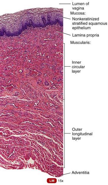 o Mucosa: Vagina - Histology Rugae: Folds of epithelial layer Mucosa dendritic cells: Are Antigen Presenting Cells (APC) perform an immune function Glycogen: which decompose into organic acids which