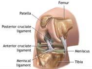 sport Medial Collateral Ligament Injury History Valgus force Minimal to