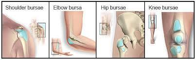 Diseases and Disorders of Bone Bursitis - inflammation of a bursa Carpal Tunnel Syndrome - occurs when the median nerve in the wrist is