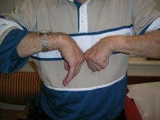 How bad can the arthritis be?