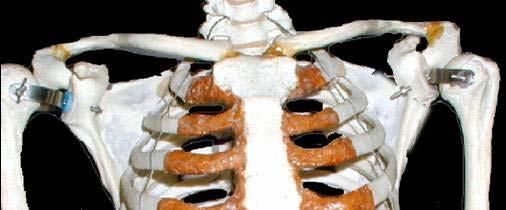 The pectoral girdle is the set of bones which connect the upper limb to the axial skeleton on each side.