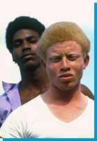 Skin color: Albinism Johnny & Edgar Winter