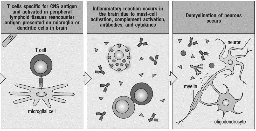 Pathogenesis of multiple
