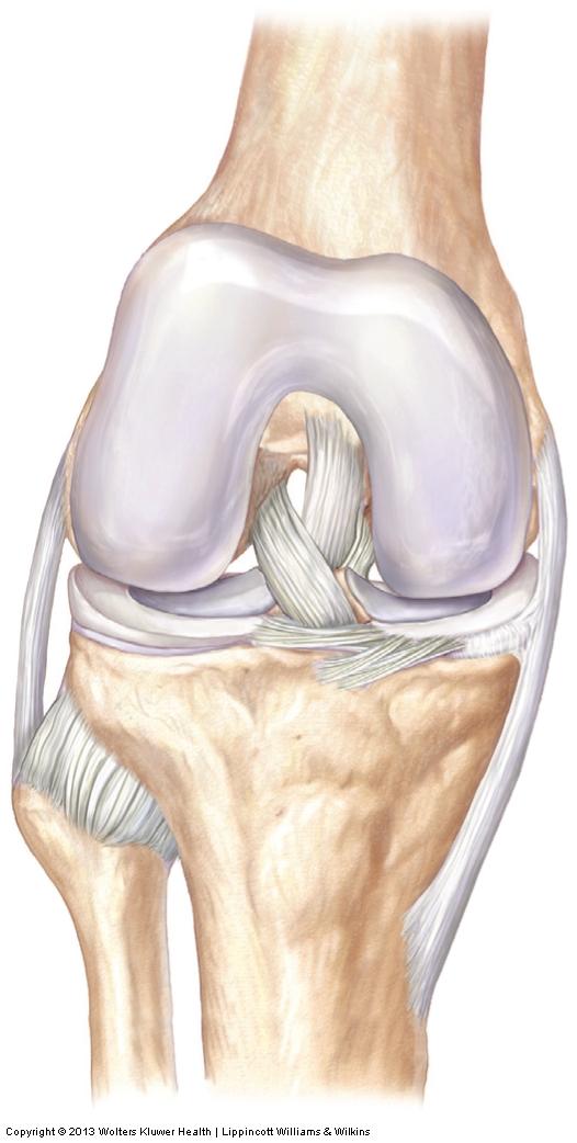 Chondromalacia Degeneration (softening) of articular cartilage.