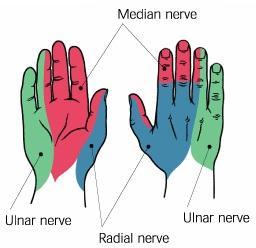Sensory supply of hand by defined Ulna Nerve Ulna 1 ½ fingers Median Nerve Radial 3