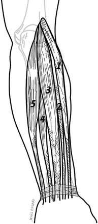 Anatomy: The Extensor System Superficial Layer 1 = extensor carpi radialis longus 2 = extensor carpi radialis