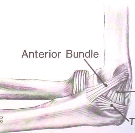 Ulnar Collateral Ligament Anterior Bundle radius ulna humerus * Anterior bundle: primary stabilizer 60-90 *