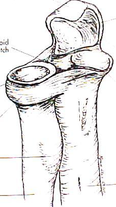 Annular Ligament Lesser Trochlear notch Radial head Radius (AL) Annular ligament (AL) Coronoid process ulna
