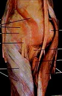 Radial Nerve Radial nerve LH Triceps MH Triceps Lateral Head Triceps Radial Nerve Triceps (LH, MH, LatH) Anconeus Brachioradialis Extensor Carpi Radialis Longus (ECRL) Anconeus Extrinsic wrist