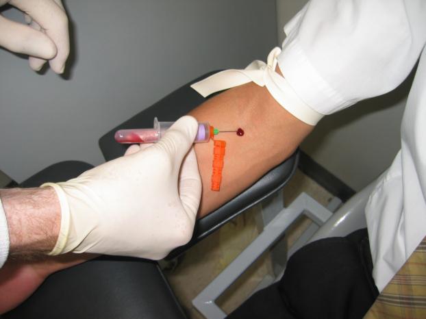 Serum/Plasma (Disadvantages-1) Invasive-sharp needle in arm Stressful-inconvenient to patient-requires driving to blood
