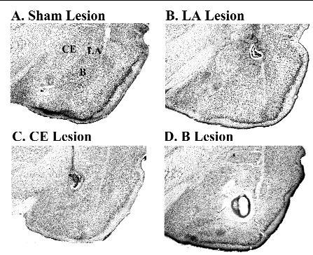 Requirement of lateral and central amygdala in conditioned fear Lesions of different amygdala nuclei