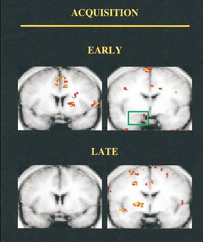 SCR (us) And the human amygdala?