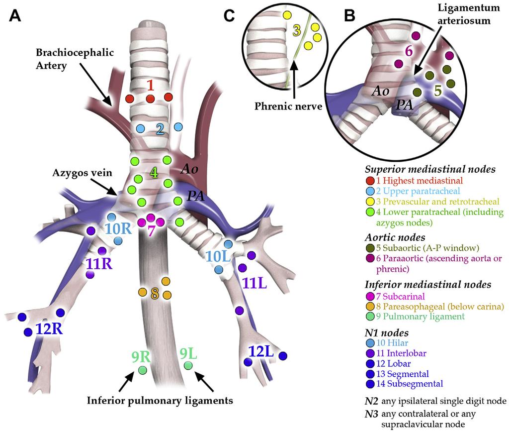Thoracic Lymph Node Classification System 355 Fig. 1. Coronal diagrams of the MD ATS lymph node map. (A) Coronal diagram of the MD-ATS map.