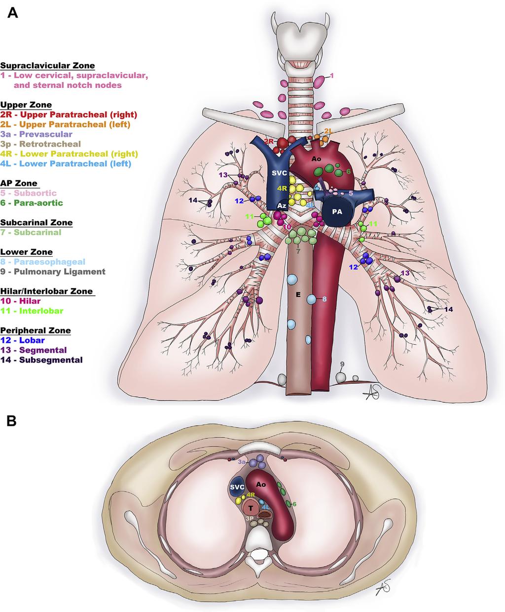 358 Jawad et al Fig. 2. (A) Coronal and (B) cross-sectional diagrams of the IASLC lymph node map.