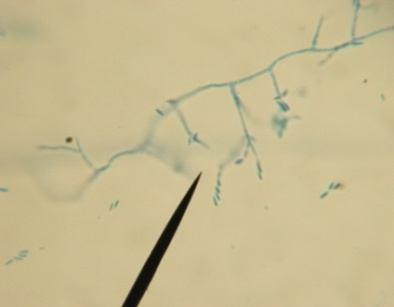 e. Helminthosporium sp h. Penicillium sp (5) Figure 5. Helminthosporium sp. Figure 8. Penicilluim sp. (4) g.