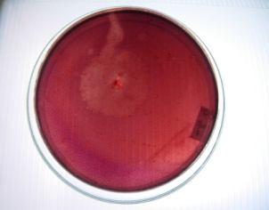 Qualitative analysis was conducted at the age of culture of 3-4 days. It could be seen clearly on the medium that the color of the colony were not so much different among the tested isolated fungi.