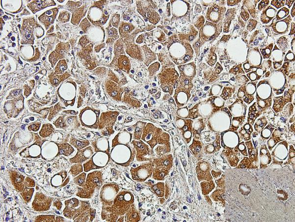 U tkivu jetre zahvaćene početnom cirozom, BMP-9 pozitivna reakcija je vidljiva u hepatocitima, nešto više na rubnim mjestima, prema perisinusoidalnim i periportalnim prostorima gdje počinje umnažanje