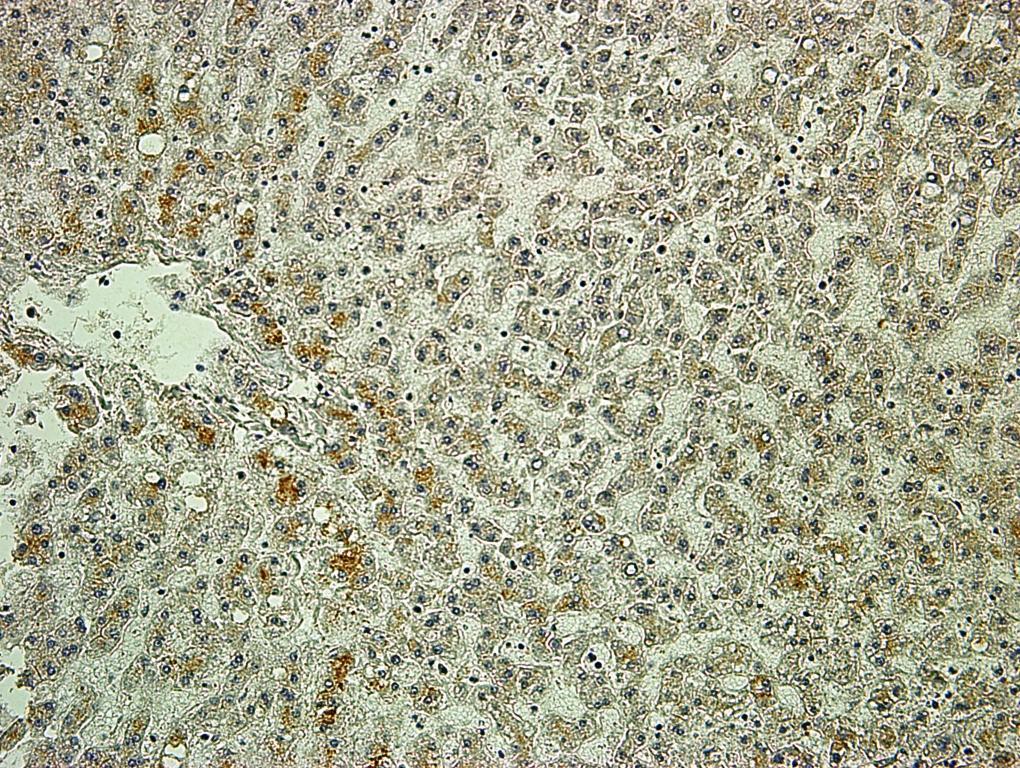 4.2.2. Ekspresija TGF-β1 u jetri čovjeka U tkivu zdrave jetre vidljiva je održana struktura hepatocita.