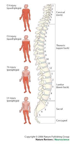 Location of impairment depends on the level of spinal cord damage: T1-T4: poor abdominal control T5-T10: trunk