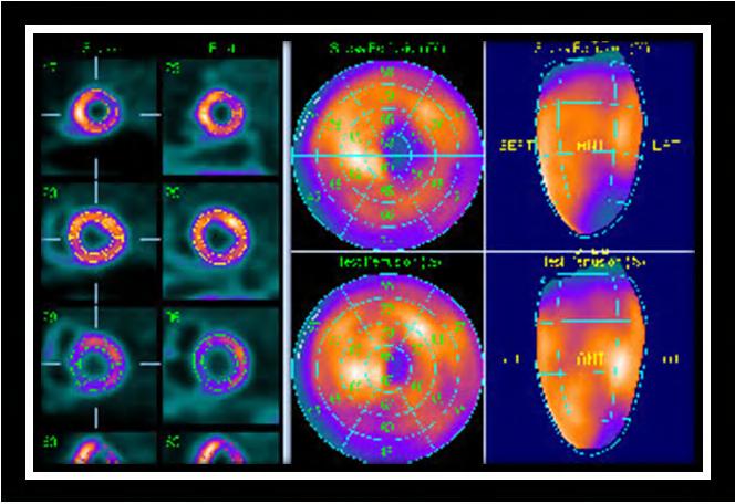 Cardiac Imaging Tests http://www.medpagetoday.com/upload/2010/11/15/23347.jpg Standard imaging tests include echocardiography, chest x-ray, CT, MRI, and various radionuclide techniques.