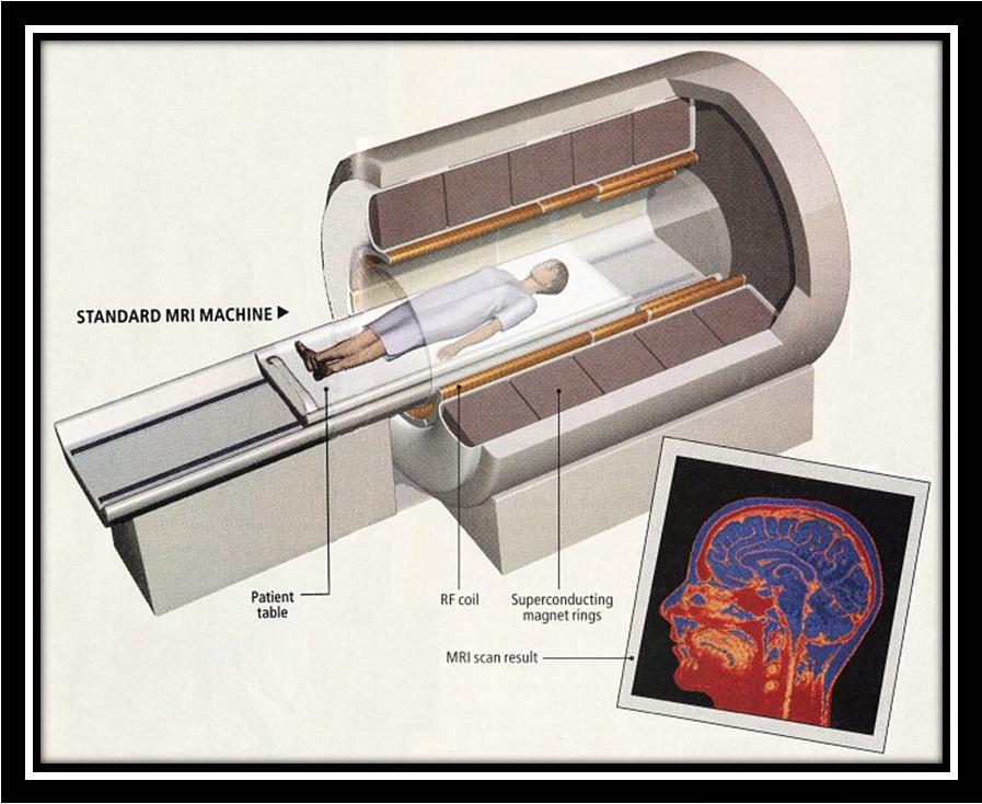 http://miriam-english.org/files/images/standard -MRI-machine.