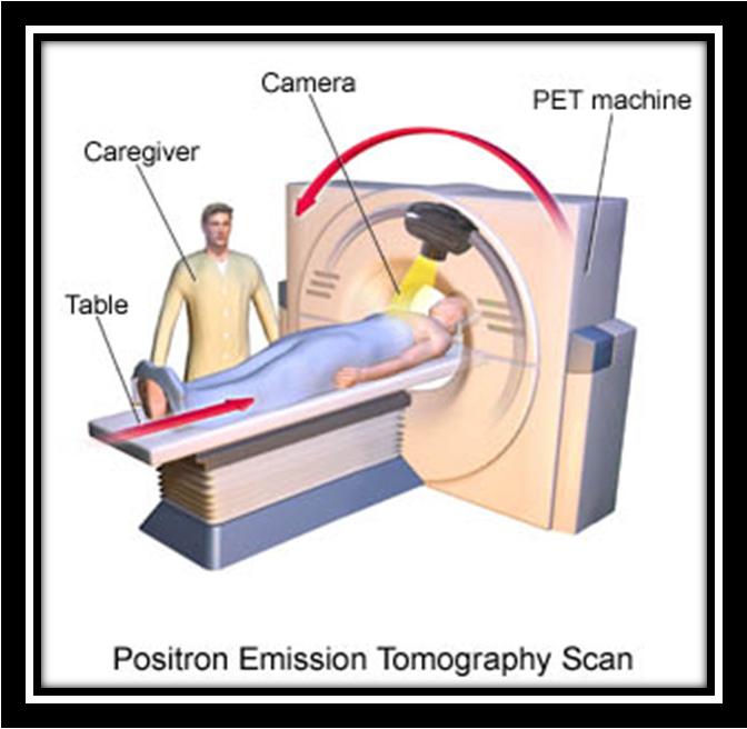 Positron emission tomography (PET): PET can demonstrate myocardial perfusion and metabolism.