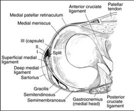 capsule Deep MCL Anatomy of the MCL Superficial MCL Femoral attachment