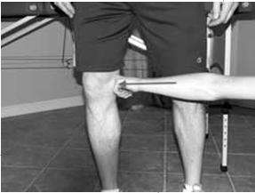 Evaluation History Blow to the anteromedial knee causing hyperextension