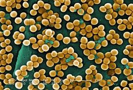 Bacterial Diseases Bacteria also are pathogens, causing diseases like cholera, diptheria, food poisoning, Lyme disease, stomach ulcers, typhoid, tetnaus, tuberculosis, and pneumonia.
