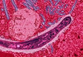 Diseases Caused by Protists (Protozoa) Some diseases caused by protists are caused by parasites (an organism that gets its