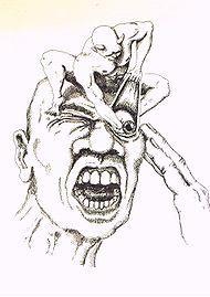 Other facts about cluster headache Episodic and chronic forms Circadian, circannual rhythms Attacks often triggered by