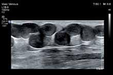 direction for premium vascular ultrasound,