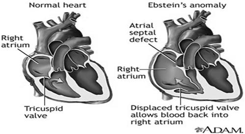 Anomaly Extremely large heart Abnormal development of the