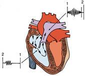 Congenital heart disease By Dr