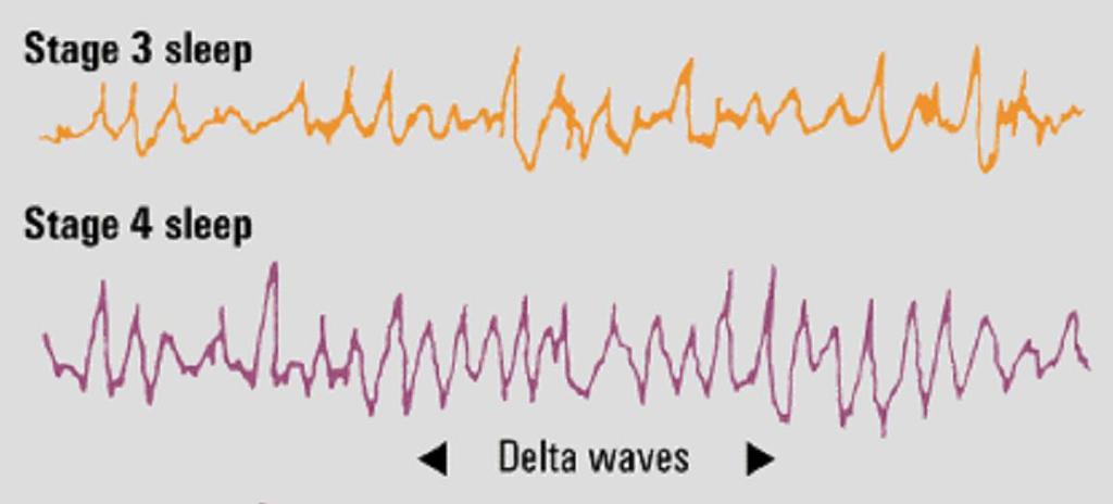 Sleep Stages During deep sleep (Stages 3 and 4), brain activity