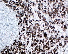 identifiable by both flow cytometry and IHC.