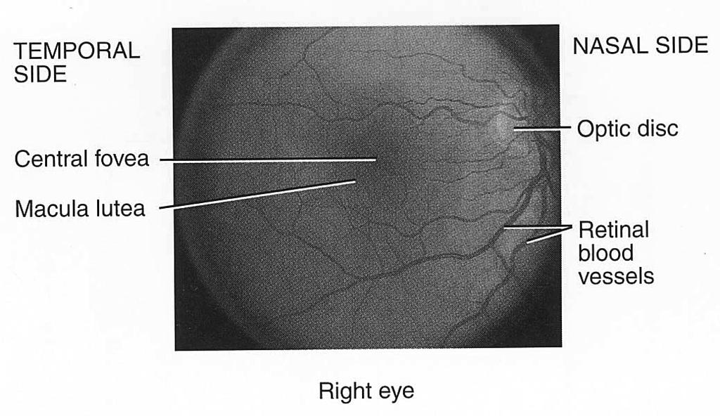 loses elasticity resulting in presbyopia 20 Lens View with Ophthalmoscope Lines