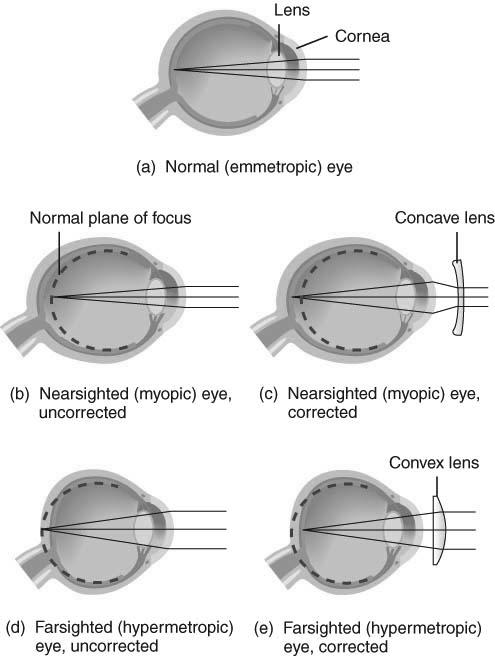 Constriction/dilation of the pupil controls amount of light entering the eye Refraction of light by cornea & lens Accommodation of the lens changing shape of lens so that light is focused 25 26