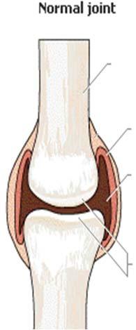 Types of Joints Joints permit bones to move without damaging each other.