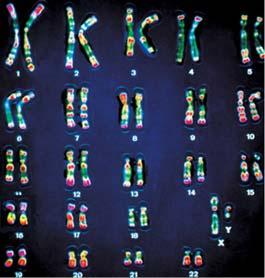 Chromosome Structure Karyotype of Human Chromosomes