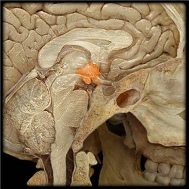 14. Which structure is highlighted (pink)? A. thalamus B. corpus callosum C. pons D.