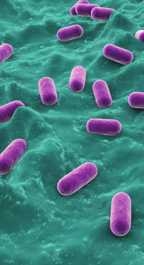 5 Important Things To Look For When Choosing A Probiotic Supplement CULTURE COUNT This refers to the total amount of bacteria per serving and can vary widely from product to product.